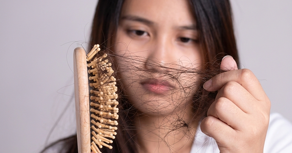 Sự thật về rụng tóc khi dùng biện pháp tránh thai nội tiết tố