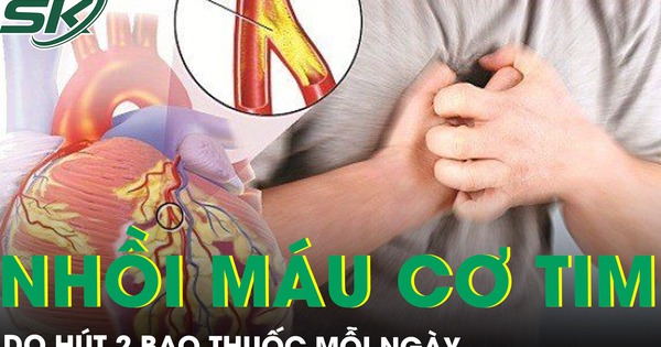 Hút 2 bao thuốc mỗi ngày, người đàn ông nhồi máu cơ tim sốc tim nguy kịch trong đêm