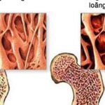 5 giải pháp đơn giản giúp duy trì xương chắc khỏe sau tuổi 50