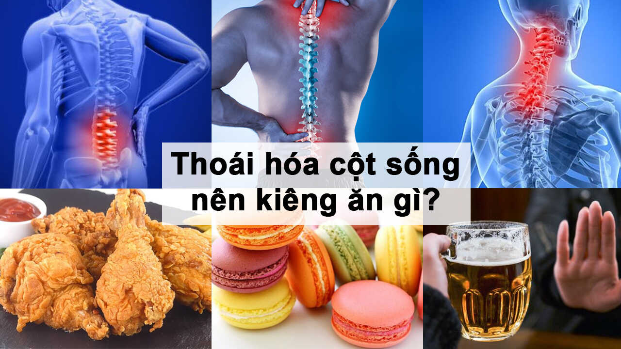 Những món ăn tốt nhất cho người bị thoái hóa cột sống- Ảnh 3.