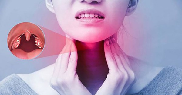 Tại sao viêm họng hạt dễ tái phát?