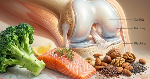 5 loại thực phẩm tốt nhất cho xương khớp khỏe mạnh