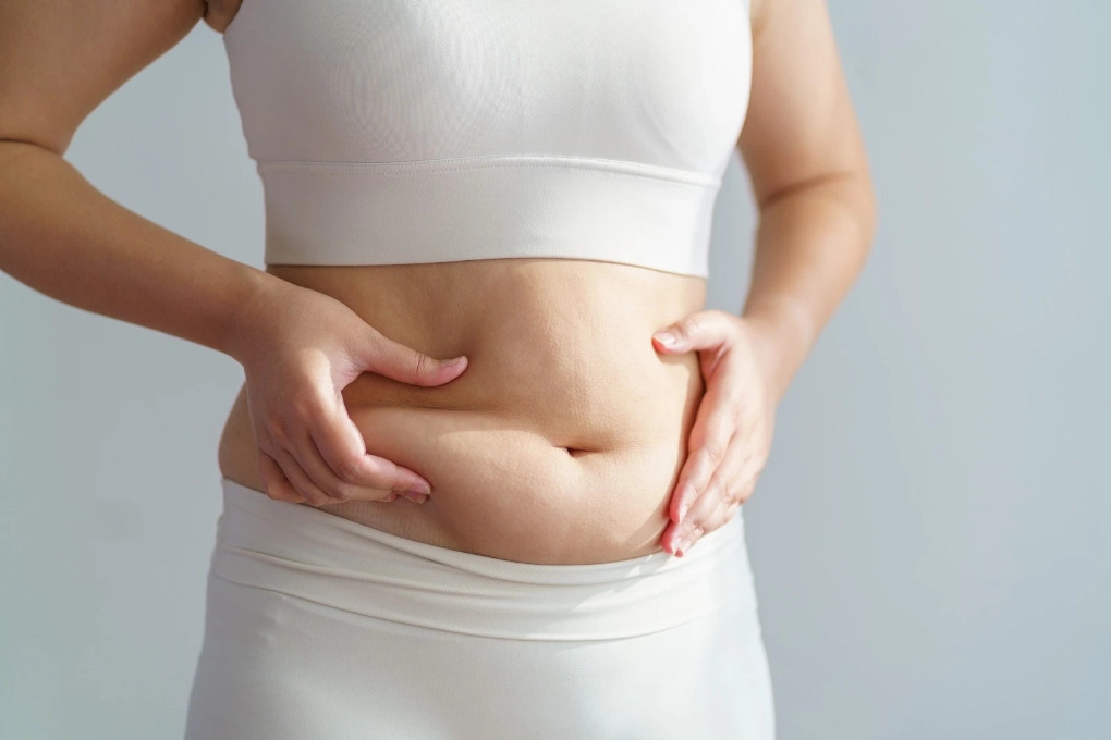 Vì sao người gầy vẫn có nhiều mỡ bụng?- Ảnh 1. Vì sao người gầy vẫn có nhiều mỡ bụng?- Ảnh 1.