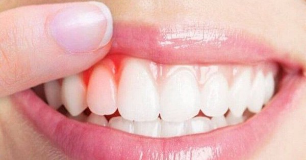 Nguyên nhân thường gặp gây chảy máu miệng và cách xử trí tại nhà