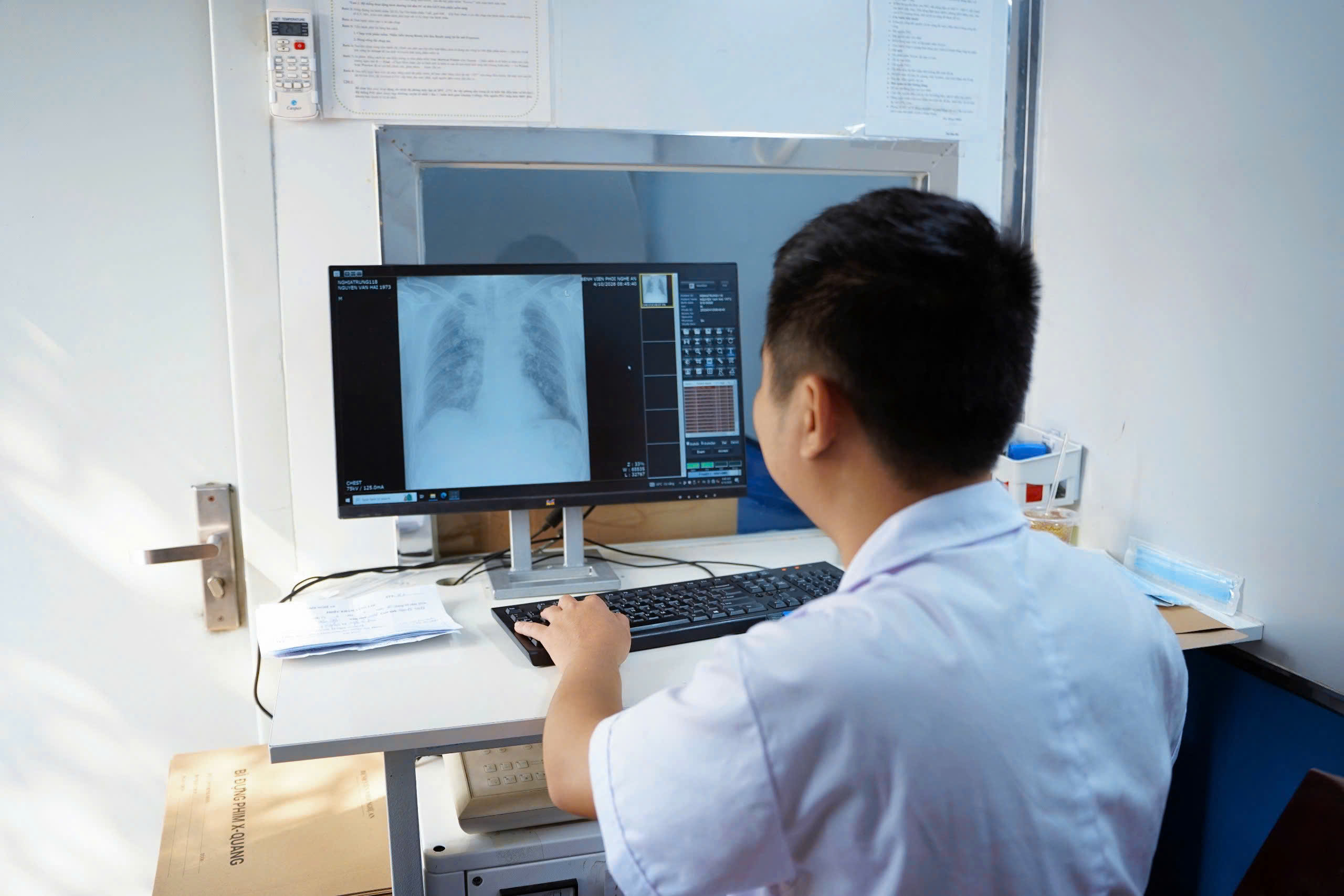 Sàng lọc cộng đồng tại Nghệ An phát hiện 171 ca nghi mắc bệnh lao- Ảnh 5. Sàng lọc cộng đồng tại Nghệ An phát hiện 171 ca nghi mắc bệnh lao- Ảnh 5.
