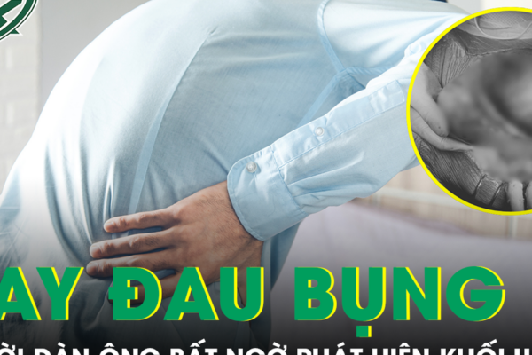 Thỉnh thoảng đau bụng, người đàn ông bất ngờ phát hiện khối u 3kg