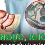 Phát hiện ung thư tiền liệt tuyến di căn từ triệu chứng đau ngực khó thở