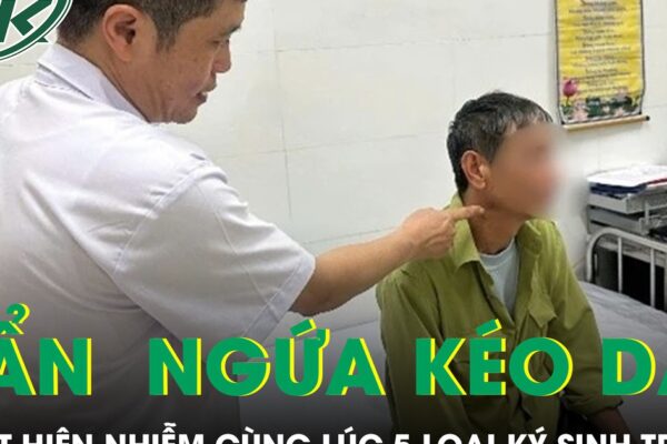 Ngứa suốt nửa năm, người đàn ông phát hiện nhiễm cùng lúc 5 loại ký sinh trùng