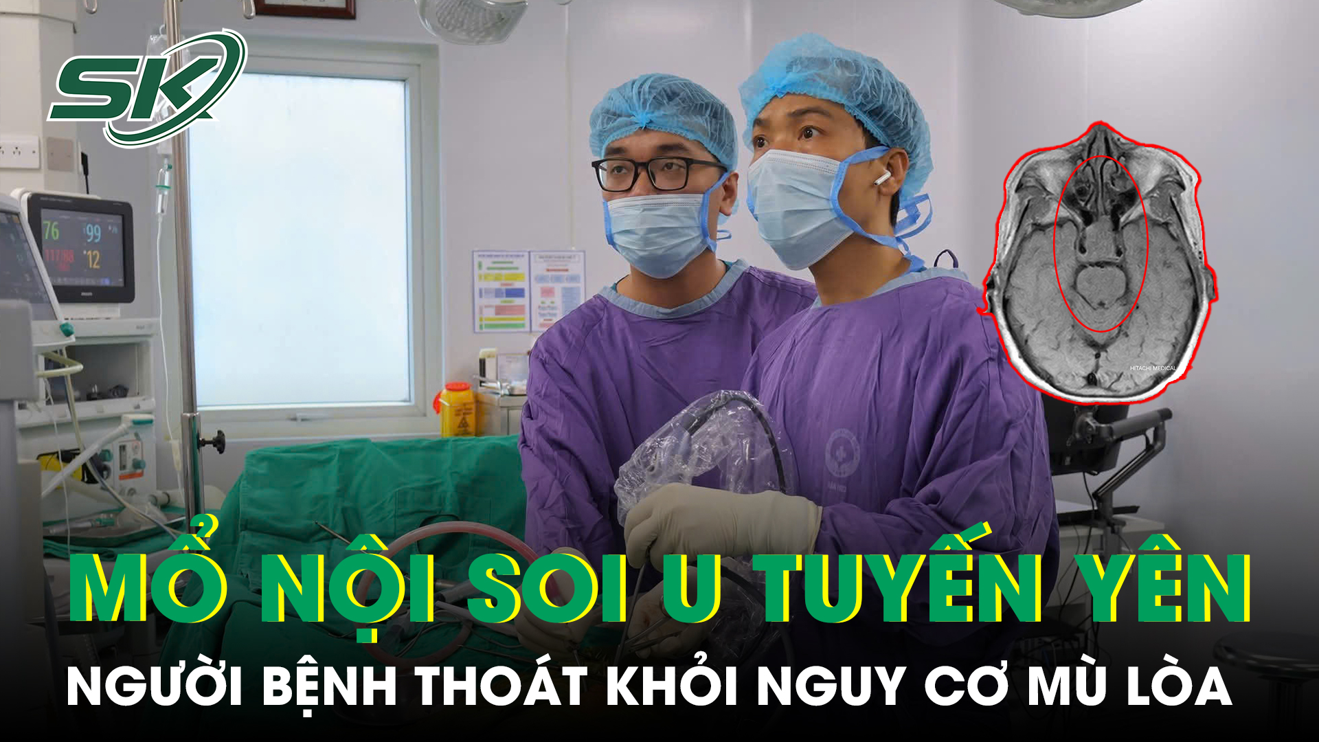 Thoát khỏi nguy cơ mù lòa nhờ phẫu thuật nội soi u tuyến yên