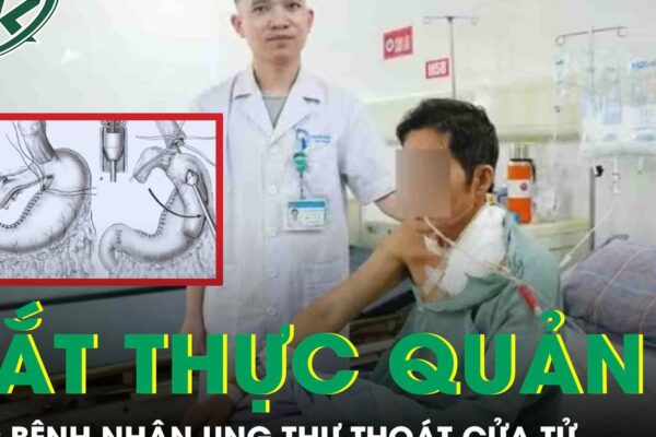 Người đàn ông phải cắt thực quản để điều trị ung thư