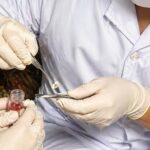Ca hiến giác mạc đầu tiên tại Bệnh viện Đa khoa Bắc Ninh số 1