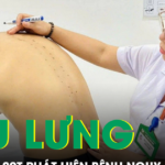Tưởng đau lưng do tập gym, nam thanh niên 20 tuổi phát hiện mắc bệnh nguy cơ gây tàn phế