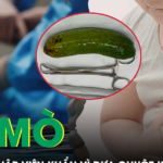 Tò mò nhét dưa chuột vào hậu môn, bé 13 tuổi nhập viện khẩn