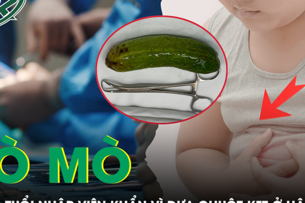 Tò mò nhét dưa chuột vào hậu môn, bé 13 tuổi nhập viện khẩn