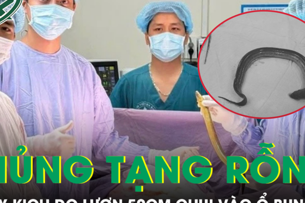 Người đàn ông thủng tạng rỗng do con lươn dài 50cm chui vào ổ bụng