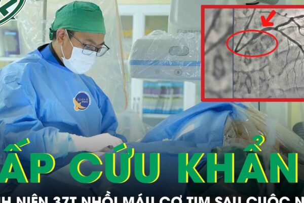 Sau cuộc nhậu, người đàn 37 tuổi bất ngờ lên cơn nhồi máu cơ tim phải cấp cứu khẩn