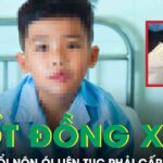 Nuốt đồng xu, bé trai 7 tuổi nôn ói liên tục phải cấp cứu khẩn