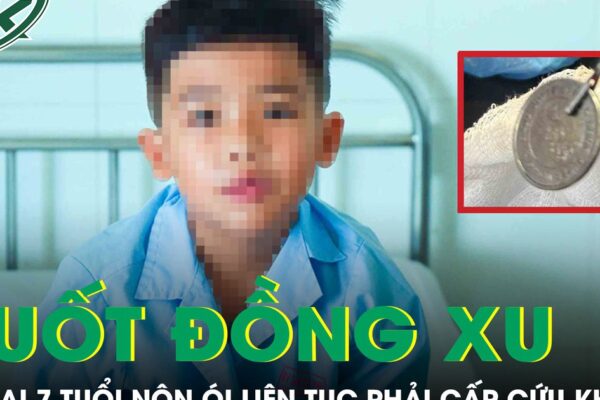 Nuốt đồng xu, bé trai 7 tuổi nôn ói liên tục phải cấp cứu khẩn