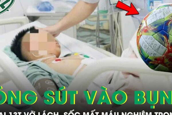 Bé trai 13 tuổi vỡ lách, sốc mất máu nghiêm trọng vì bị bóng sút vào bụng