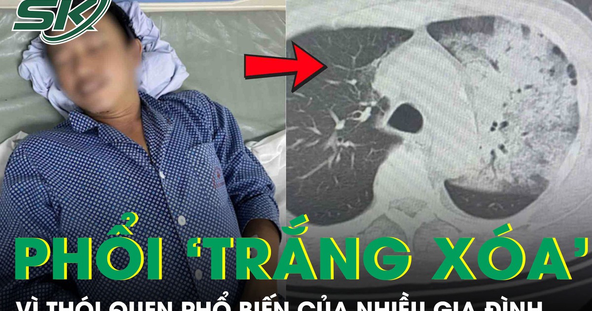 Tưởng cảm cúm, người đàn ông bất ngờ suy đa tạng, phổi ‘trắng xoá’ vì thói quen nhiều người mắc