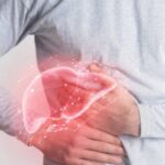 Chủ quan khi mắc xơ gan, nhiều biến chứng đe dọa tính mạng