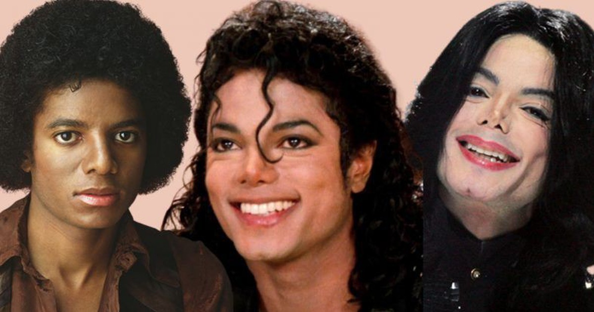 Sự thật về căn bệnh hiếm khiến Michael Jackson phải tẩy trắng da