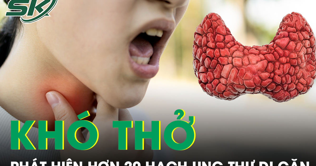 Khó thở mất tiếng, người phụ nữ phát hiện hơn 20 hạch ung thư di căn