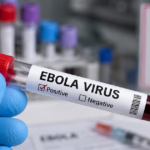 Bác sĩ Bạch Mai chỉ ra quy tắc ‘2 – 5 – 30’ trong ngăn chặn Ebola