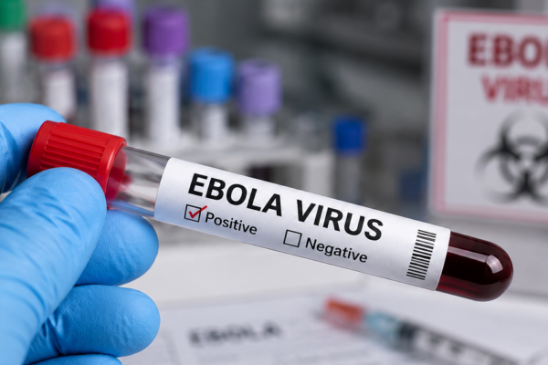 Bác sĩ Bạch Mai chỉ ra quy tắc ‘2 – 5 – 30’ trong ngăn chặn Ebola