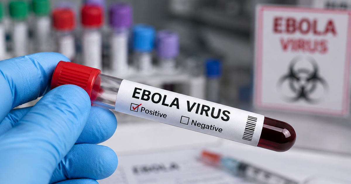 Bác sĩ Bạch Mai chỉ ra quy tắc ‘2 – 5 – 30’ trong ngăn chặn Ebola
