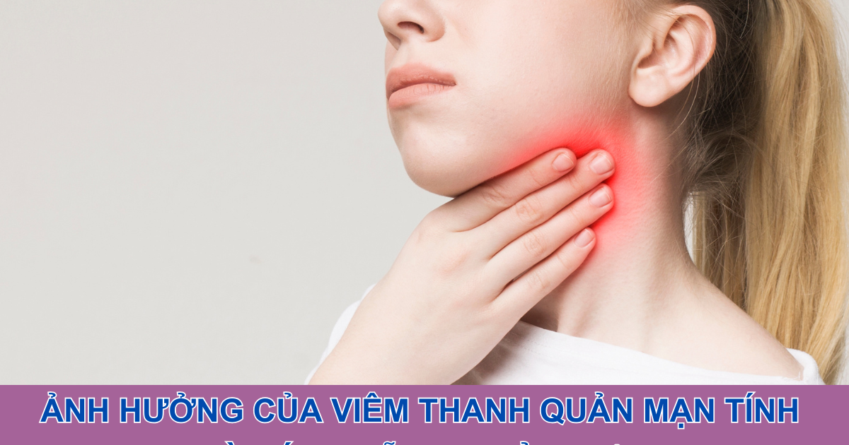 Ảnh hưởng của viêm thanh quản mạn tính và cách hỗ trợ cải thiện