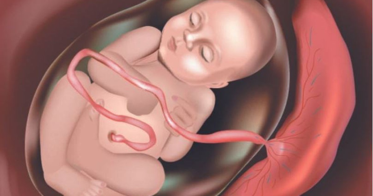 Cảnh báo nhau cài răng lược ở phụ nữ mang thai