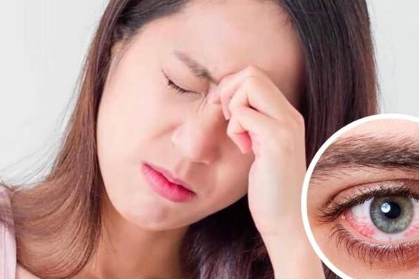 Đau hốc mắt cảnh báo bệnh gì?