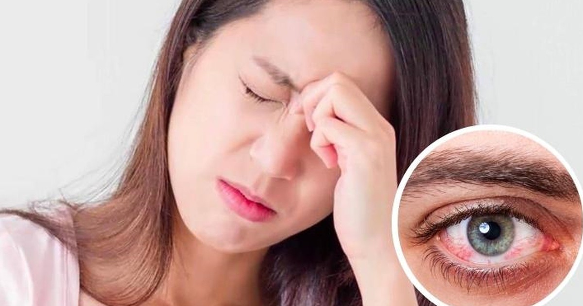 Đau hốc mắt cảnh báo bệnh gì?