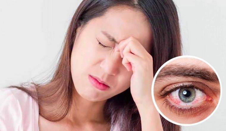 dau-mat-16926802699641489048579-1706538923284577683260 Đau hốc mắt cảnh báo bệnh gì?- Ảnh 2.