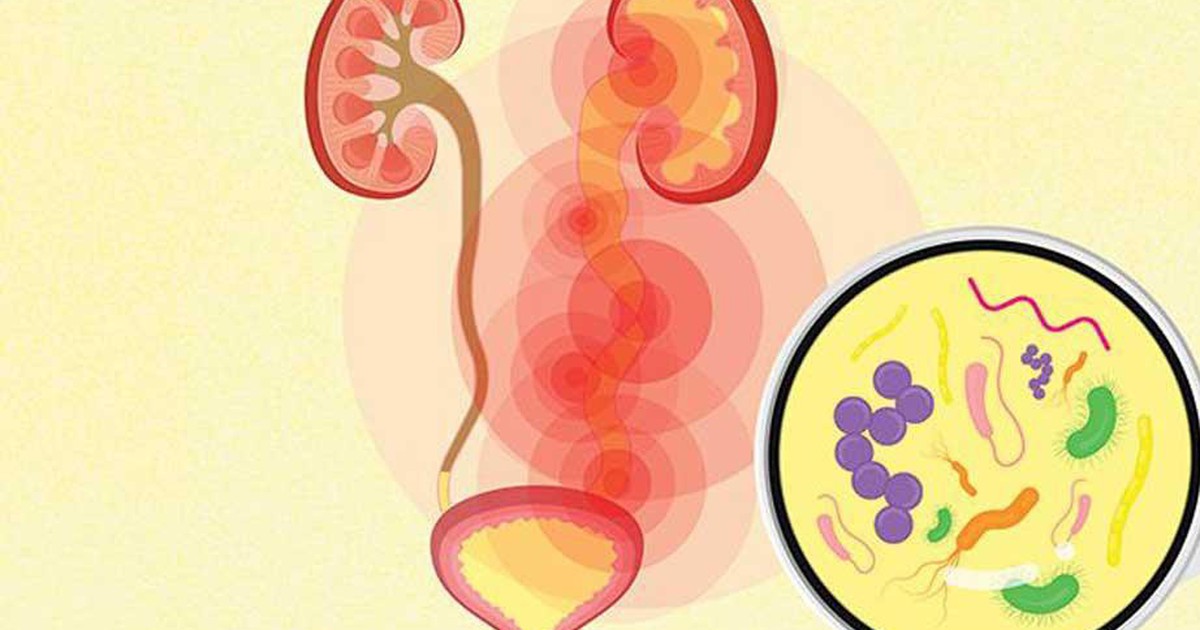 Nhiễm khuẩn tiết niệu có biểu hiện như thế nào?