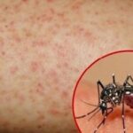 Hơn 1.100 ca mắc sốt xuất huyết, Lâm Đồng kích hoạt các biện pháp phòng, chống dịch