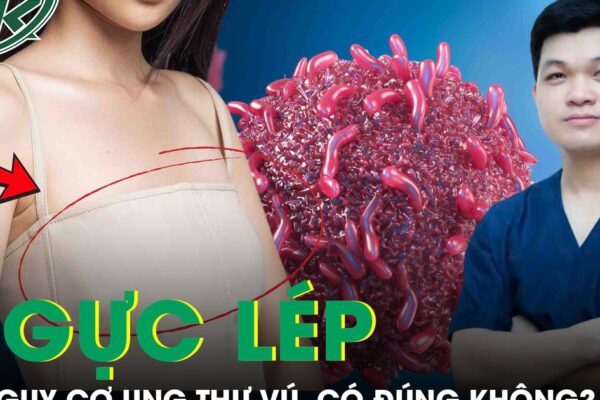 Phụ nữ ngực lép có ít nguy cơ bị ung thư vú hơn không?