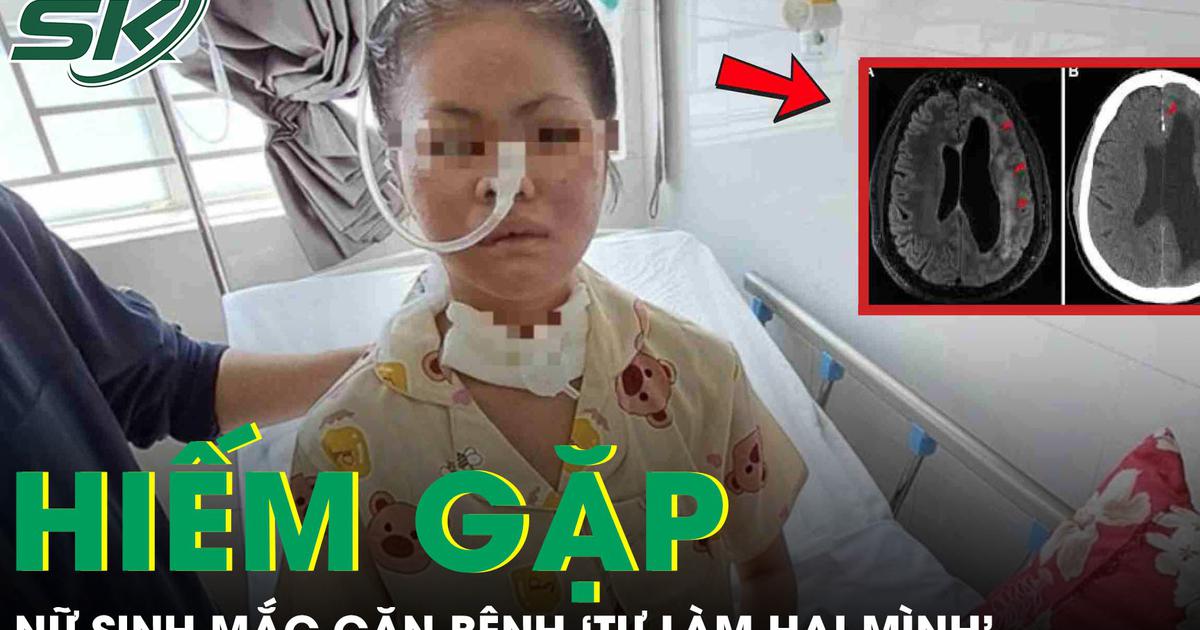 Nữ sinh 19 tuổi mắc căn bệnh ‘tự làm hại mình’ hiếm gặp