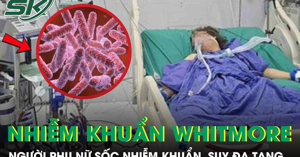 Người phụ nữ 43 tuổi sốc nhiễm khuẩn, suy đa tạng sau 5 ngày sốt