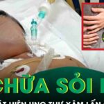 Tự chữa sỏi mật tại nhà, người đàn ông tá hỏa phát hiện ung thư xâm lấn gan