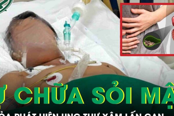 Tự chữa sỏi mật tại nhà, người đàn ông tá hỏa phát hiện ung thư xâm lấn gan