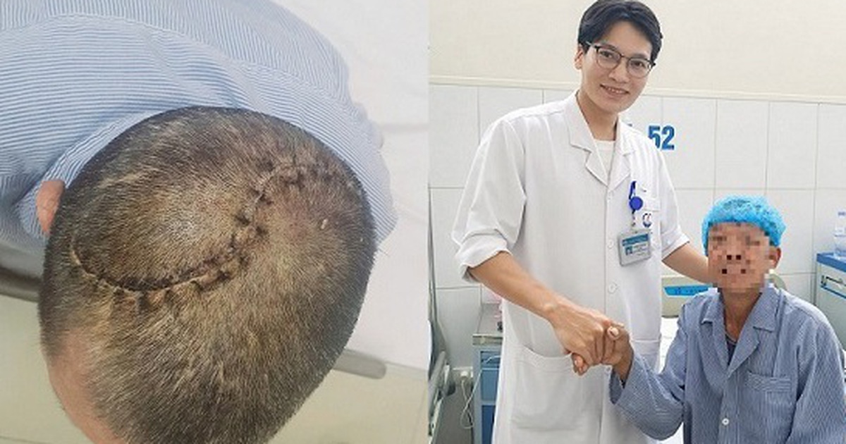 90 phút ‘nghẹt thở’ cứu người đàn ông bị vỡ lún sọ, tràn máu màng phổi