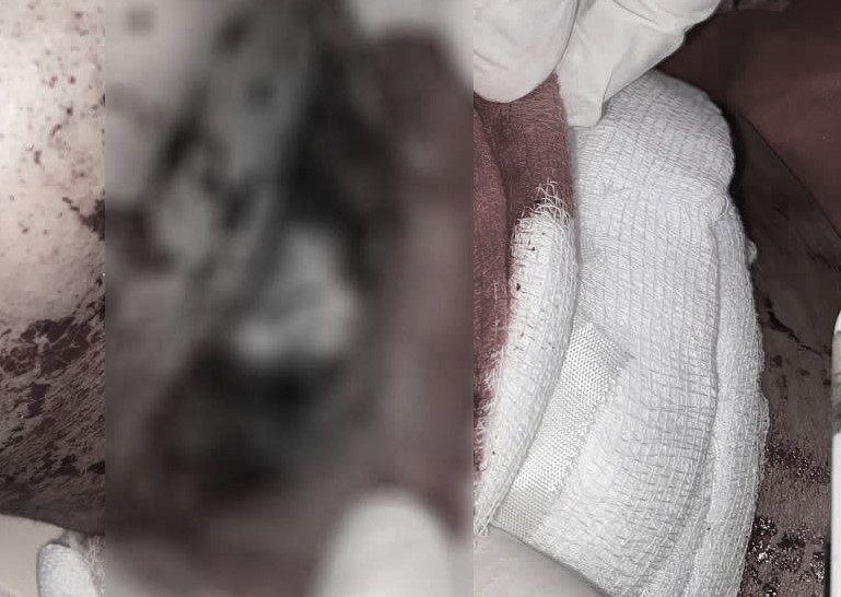 vet-rach-co-17816658349171203656908 - Ảnh 1.